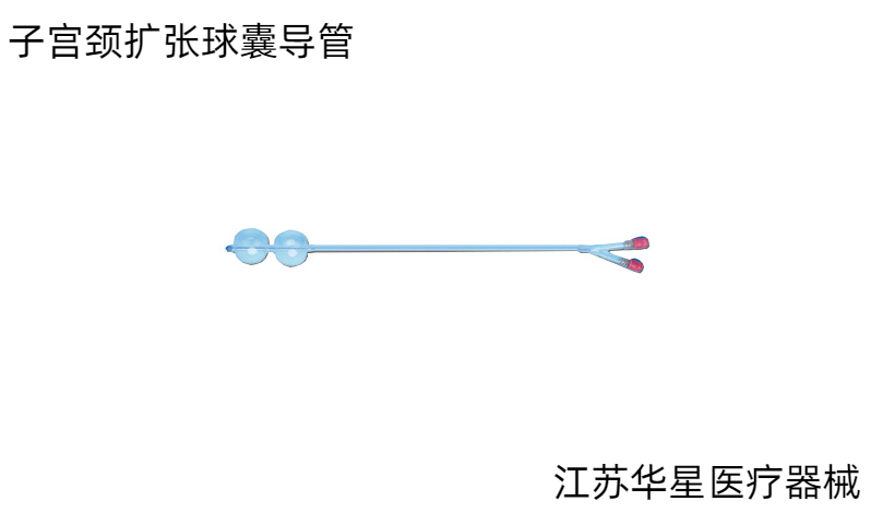 子宮頸擴(kuò)張球囊導(dǎo)管：功能、組成與應(yīng)用